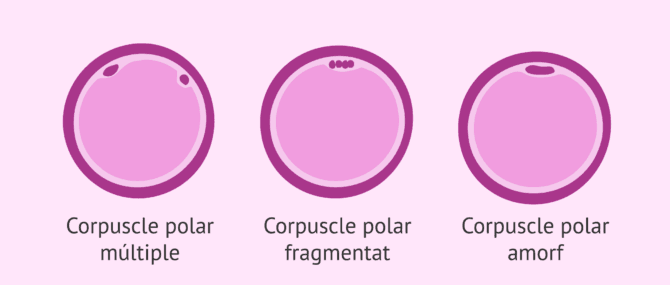 Imagen: Alteracions del corpuscle polar en els ovòcits