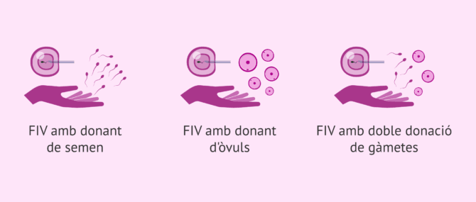 Imagen: Alternatives de la FIV amb canvi de gàmetes