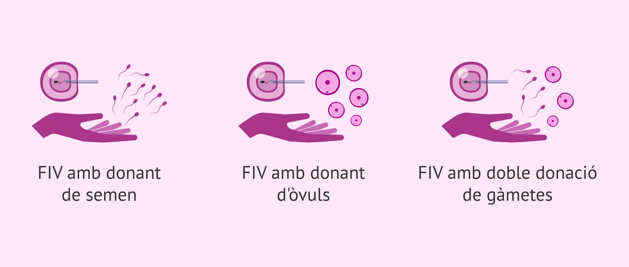 Alternatives de la FIV amb canvi de gàmetes