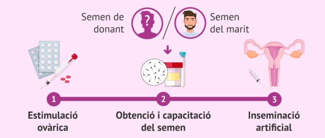 Imagen: Procés de la IA amb semen conjugal o de donant