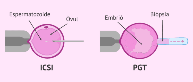 Imagen: Tècniques complementàries en FIV
