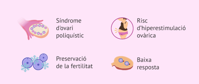 Imagen: Indicacions de la maduració in vitro (MIV)