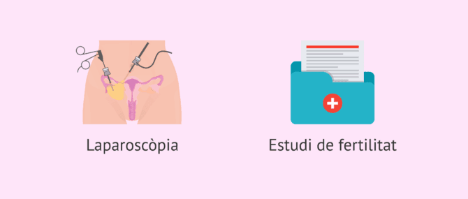 Imagen: Proves prèvies a la reversió tubàrica