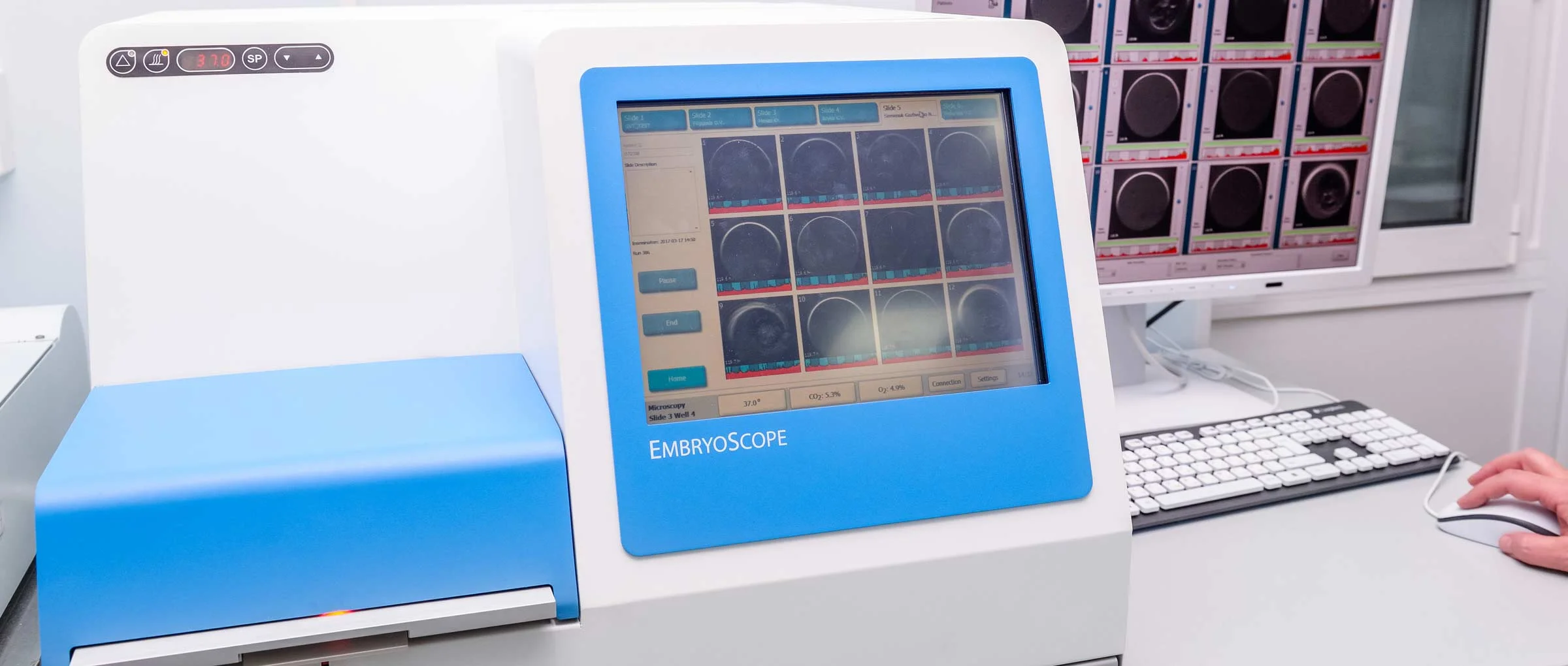 Imagen: Embrions en Embryoscope