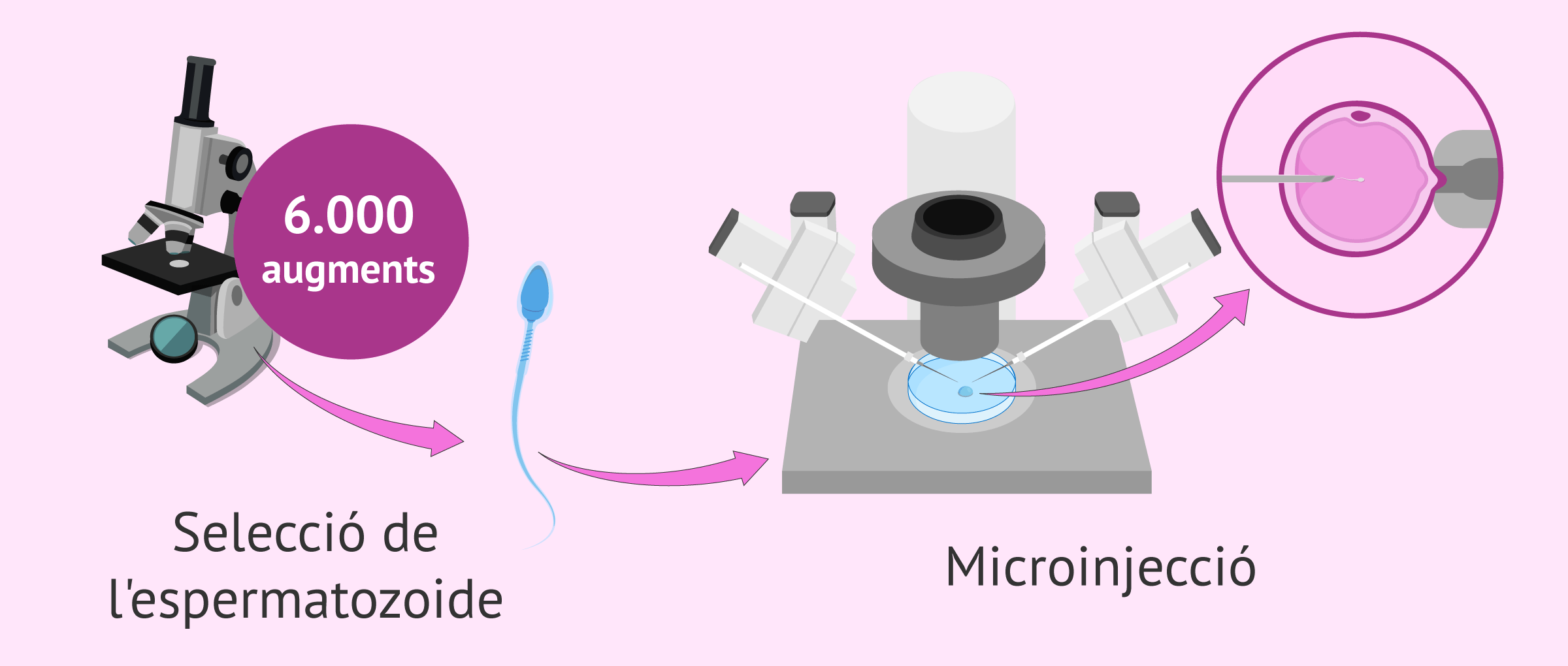Imagen: Microinjecció amb IMSI