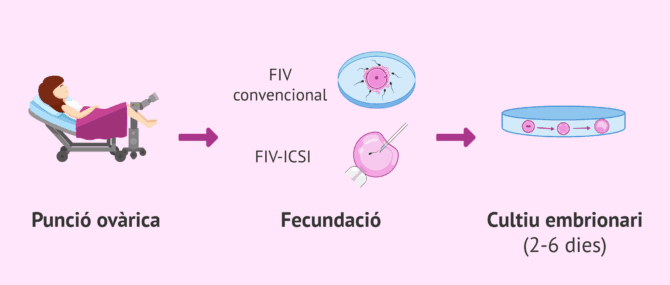 Imagen: Punció ovàrica i dia 0 de desenvolupament embrionari