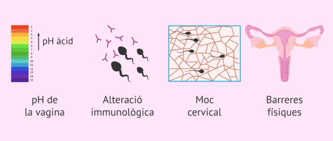 Imagen: Obstacles per al viatge dels espermatozoides