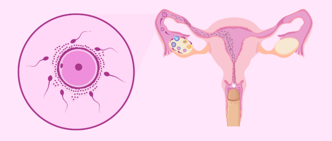 Imagen: Obstacles en el recorregut per l'aparell reproductor femení