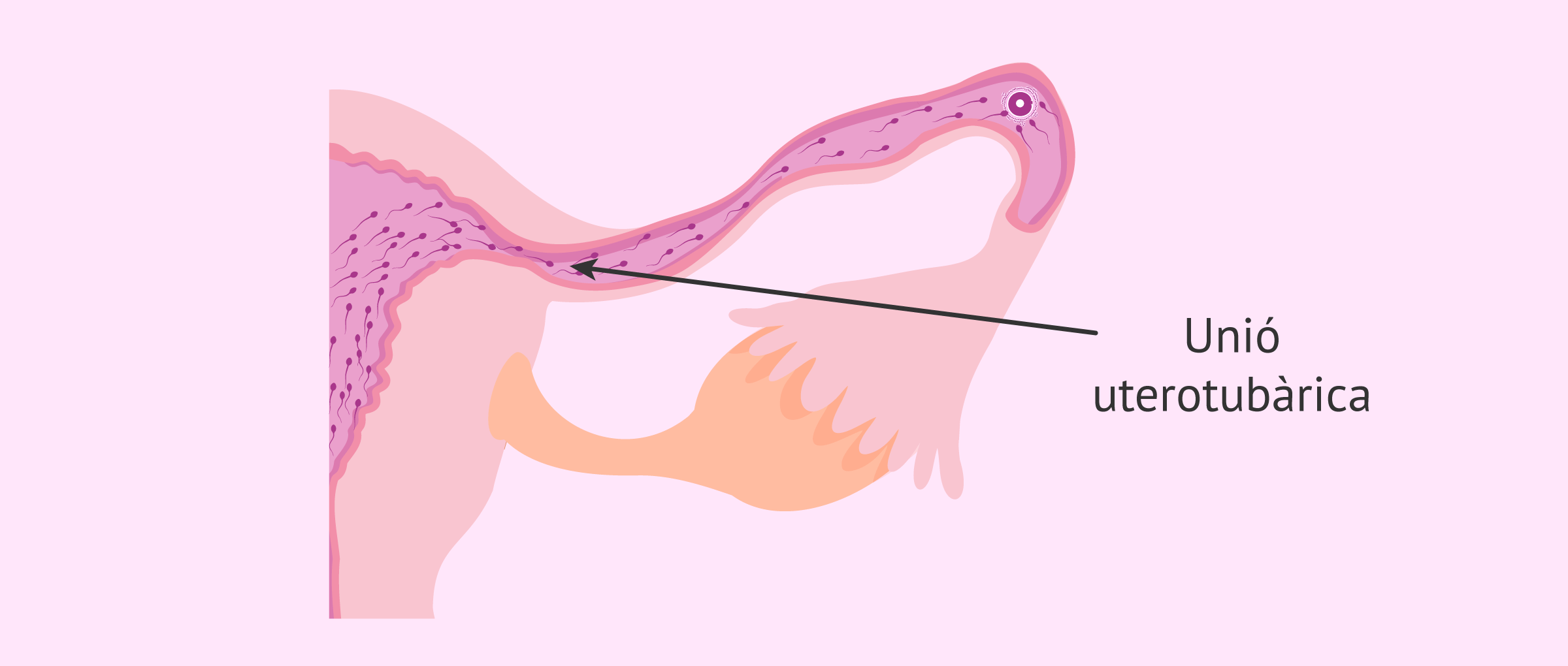 La unió uterotubárica: la zona més estreta del camí dels espermatozoides
