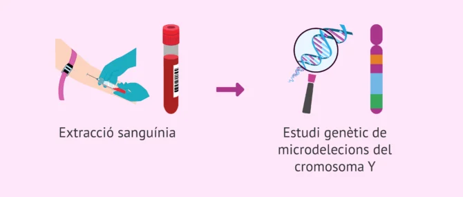 Imagen: Com es fa el diagnòstic de les microdelecions del cromosoma I?