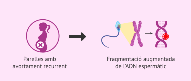Imagen: Fragmentació de l'ADN espermàtic i avortament recurrent