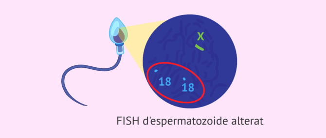 Imagen: FISH d'espermatozoides alterat