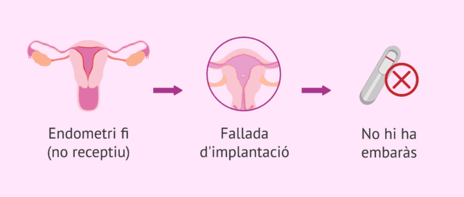 Imagen: Quan està indicada la raspatge endometrial?
