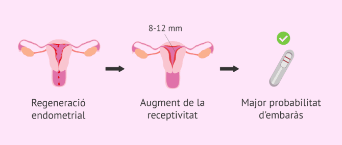 Imagen: Objectius del rascat endometrial
