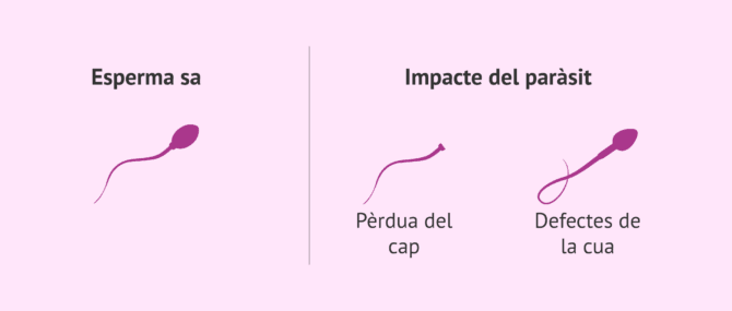 Imagen: Efectes de la toxoplasmosi en els espermatozoides