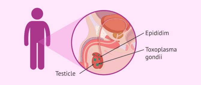 Imagen: Afecta el toxoplasma a la fertilitat de l'home?