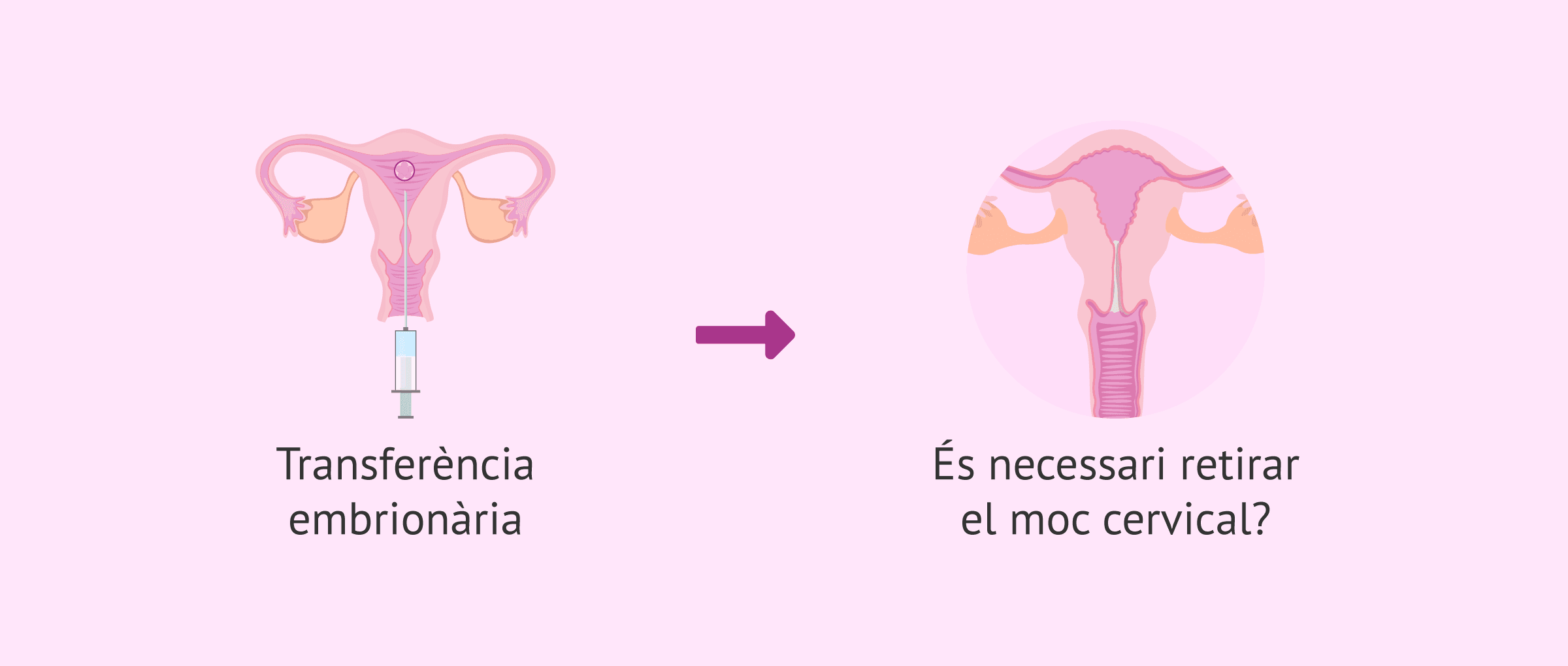 Netejar el moc cervical en la FIV: Per què aquest pas mèdic sobra