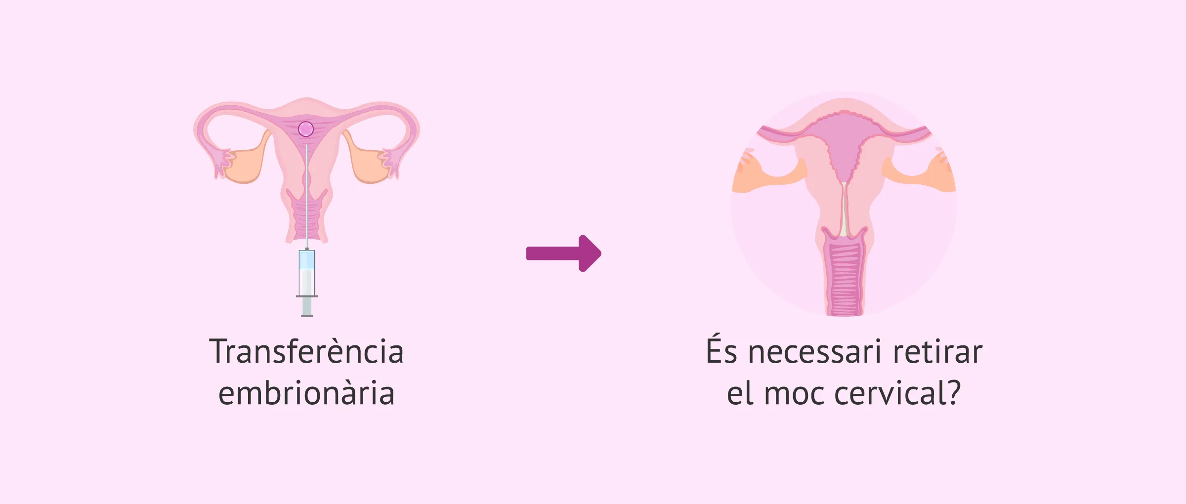 Netejar el moc cervical en la FIV: Per què aquest pas mèdic sobra