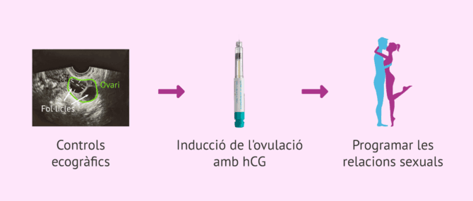 Imagen: Coit programat per a dones amb SOP