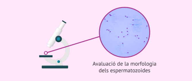 Imagen: Avaluar la morfologia dels espermatozoides