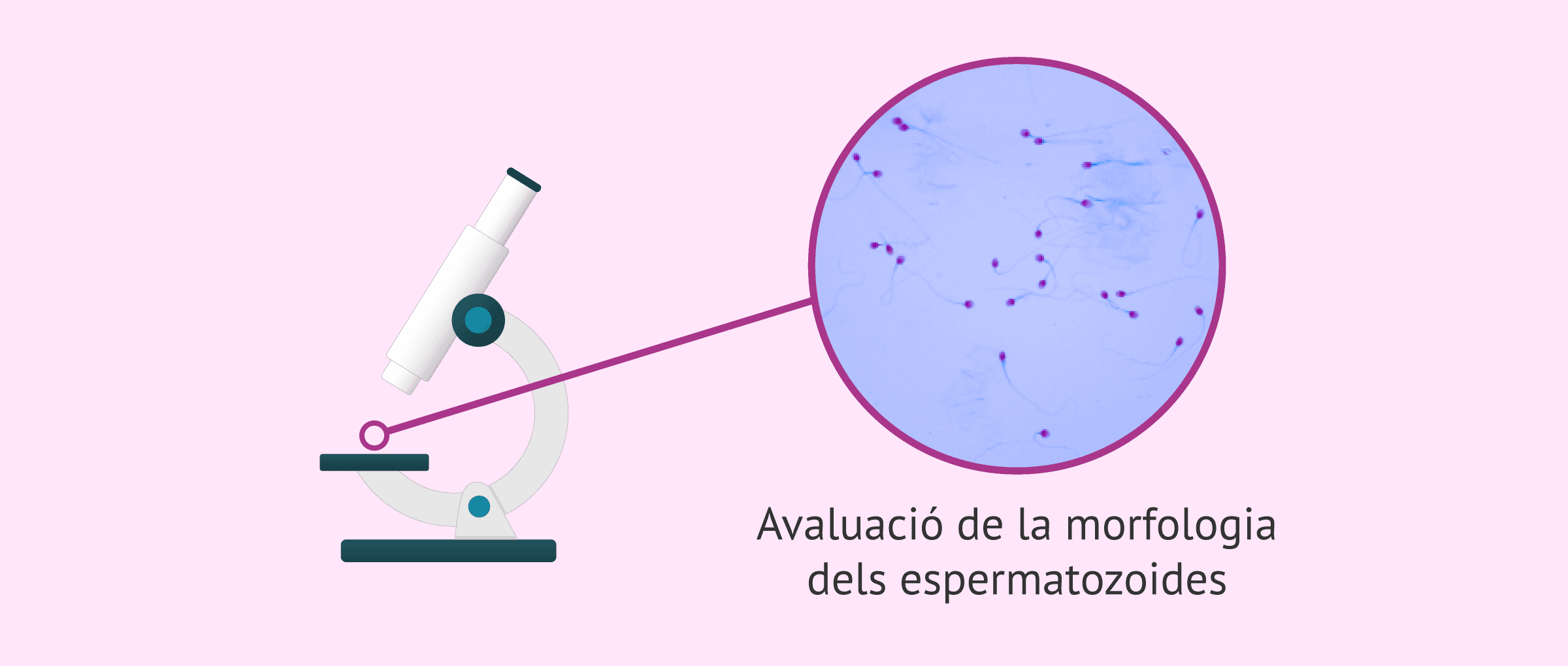 Morfologia espermàtica: quins són els valors normals?