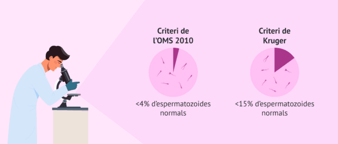Imagen: Nivell de referència per a la morfologia espermàtica
