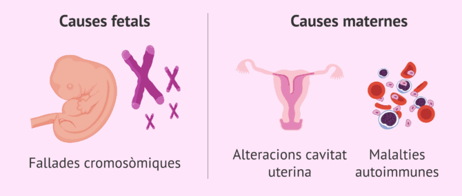 Imagen: Possibles causes de l'avortament espontani