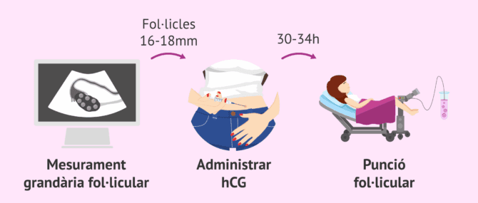 Imagen: Control de l'estimulació i programació de la punció ovàrica