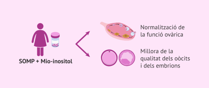 Imagen: Myo-inositol en reproducció assistida